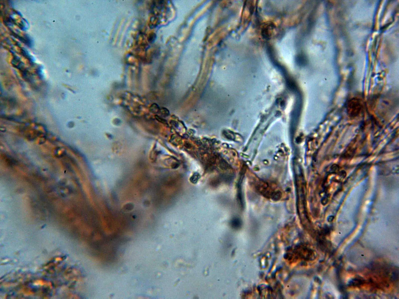 Microscopía de Lachnella villosa - 12 - Pelos con incrustaciones